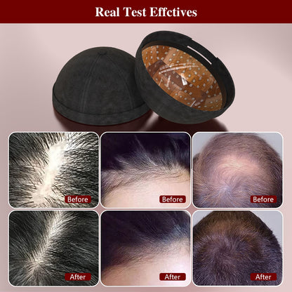 236 Diodes Laser Hair Growth Cap