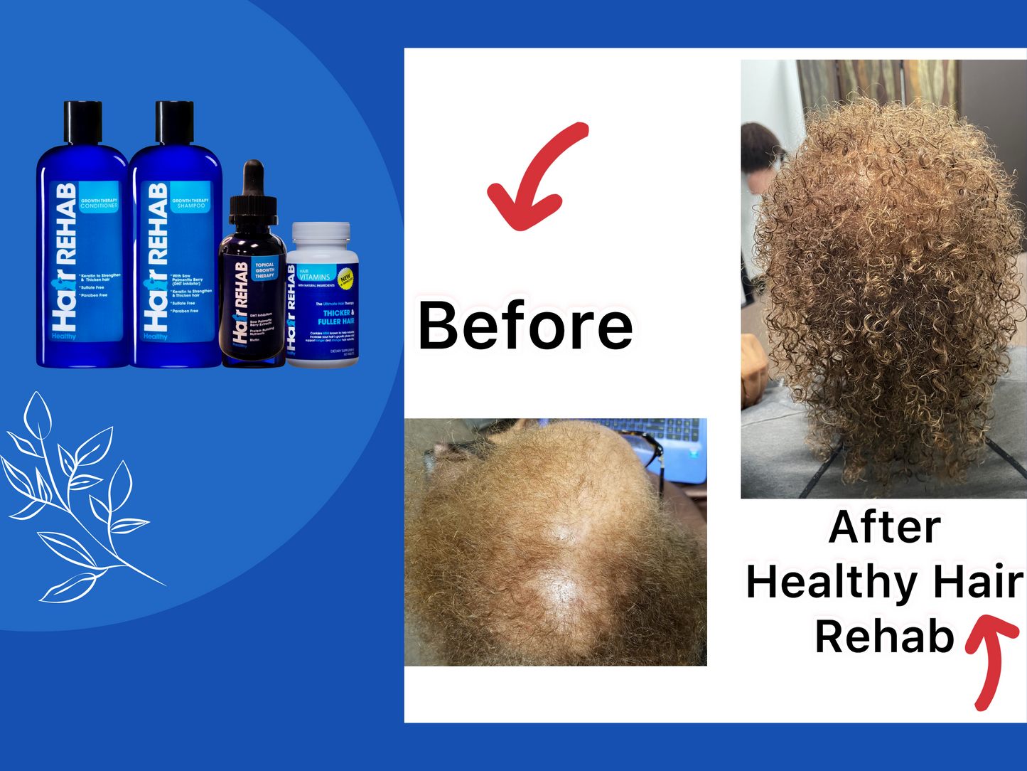 Hair Growth Rehab Combo