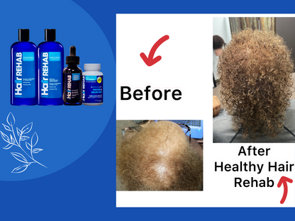 Hair Growth Rehab Combo