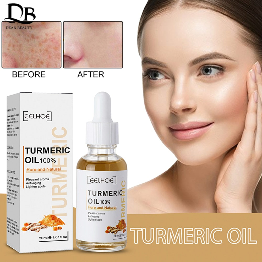 30ml Turmeric Oil Skin To Lightening Acne Dark Patches